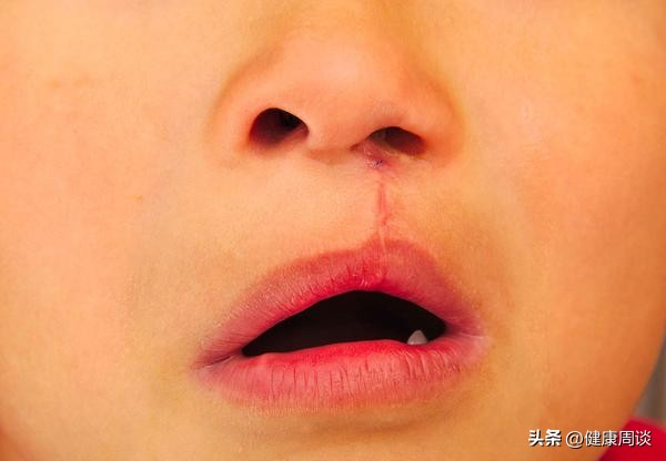 孕妇缺乏叶酸会导致什么情况发生,孕妇缺乏叶酸会导致胎儿发生什么