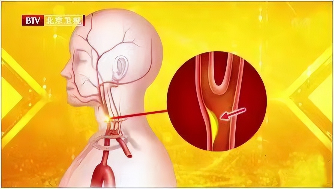 人体最脆弱的6个部位，伤到哪个都有致命的风险