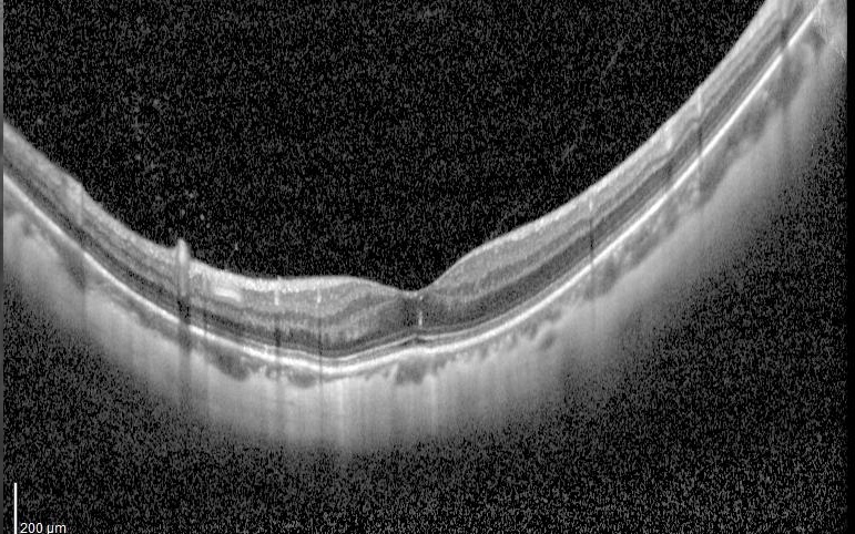 我和来自美国求医的Jason过了一个虚惊一场的父亲节