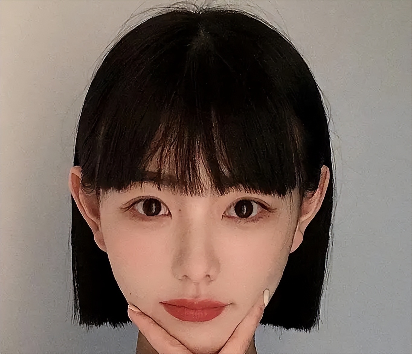 葛林若额头总是长小痘痘怎么办