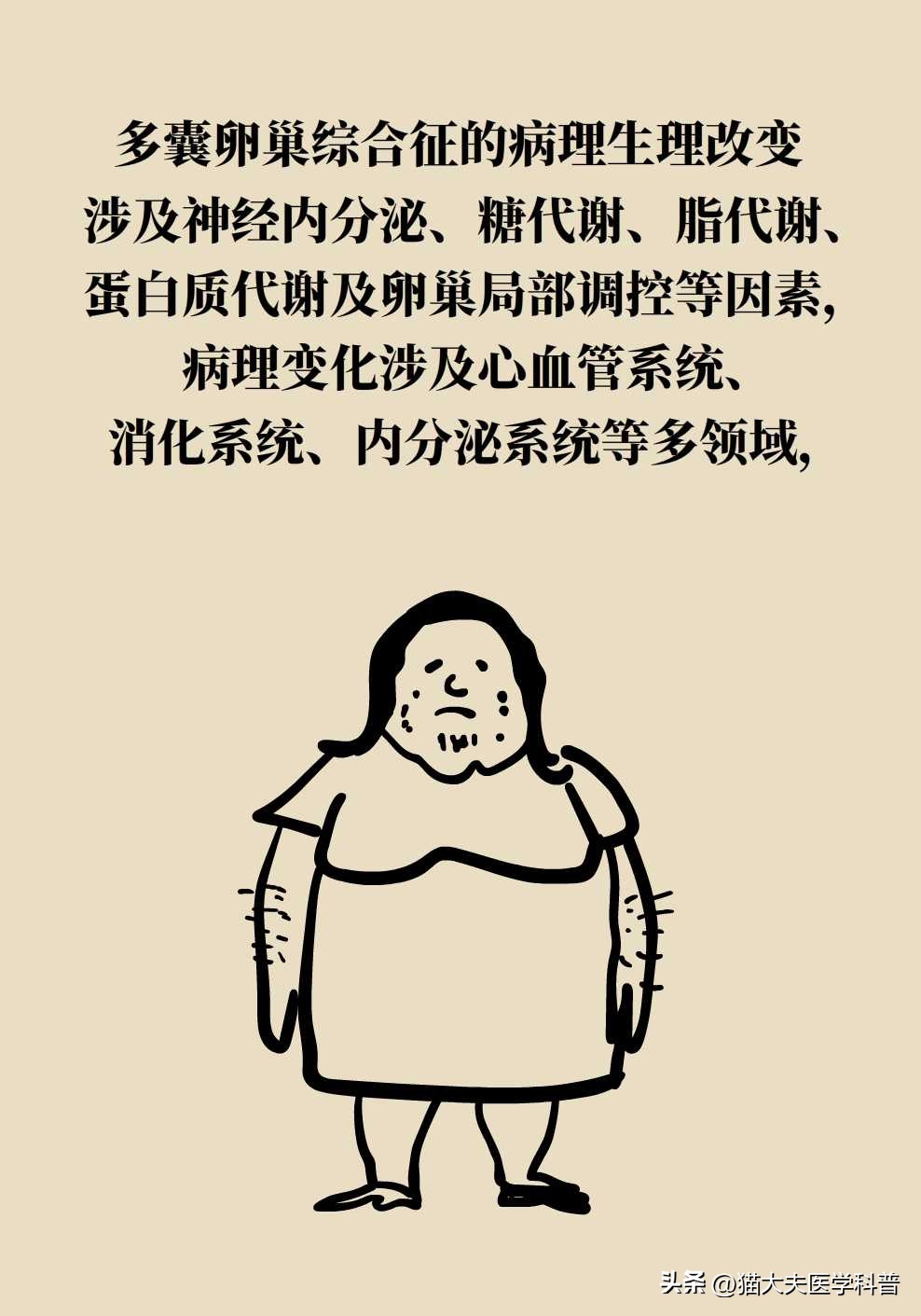 如果不要孩子多囊卵巢需要治疗吗,多囊卵巢综合征有必要治吗