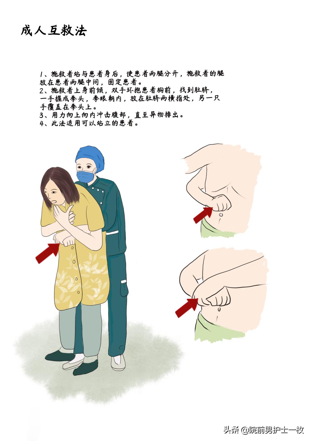 紧急救援海姆立克急救法,三分钟学会海姆立克急救法