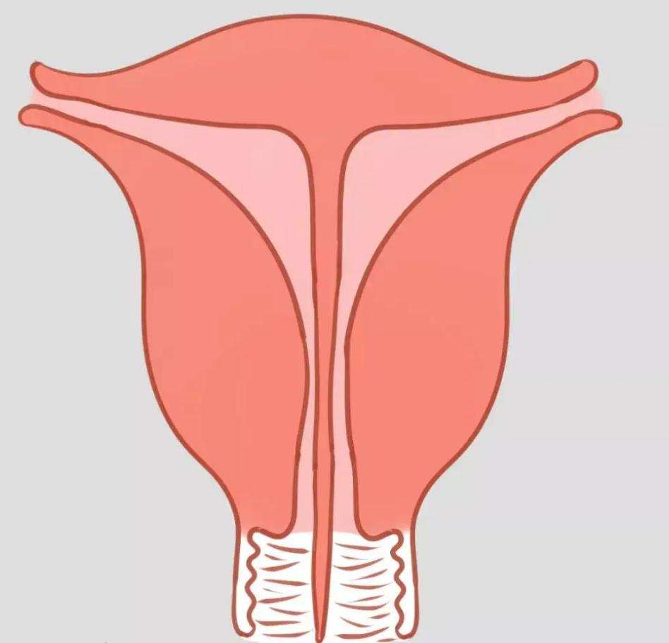 七种子宫形状，你了解过吗？