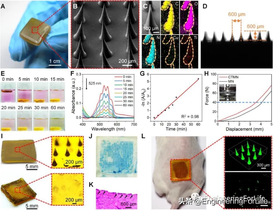 《ActaBiomater.》:超声激活微针用于声温抗菌治疗