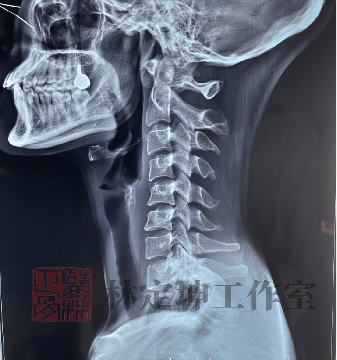 骨科的三大谣言你都知道吗,医林正骨