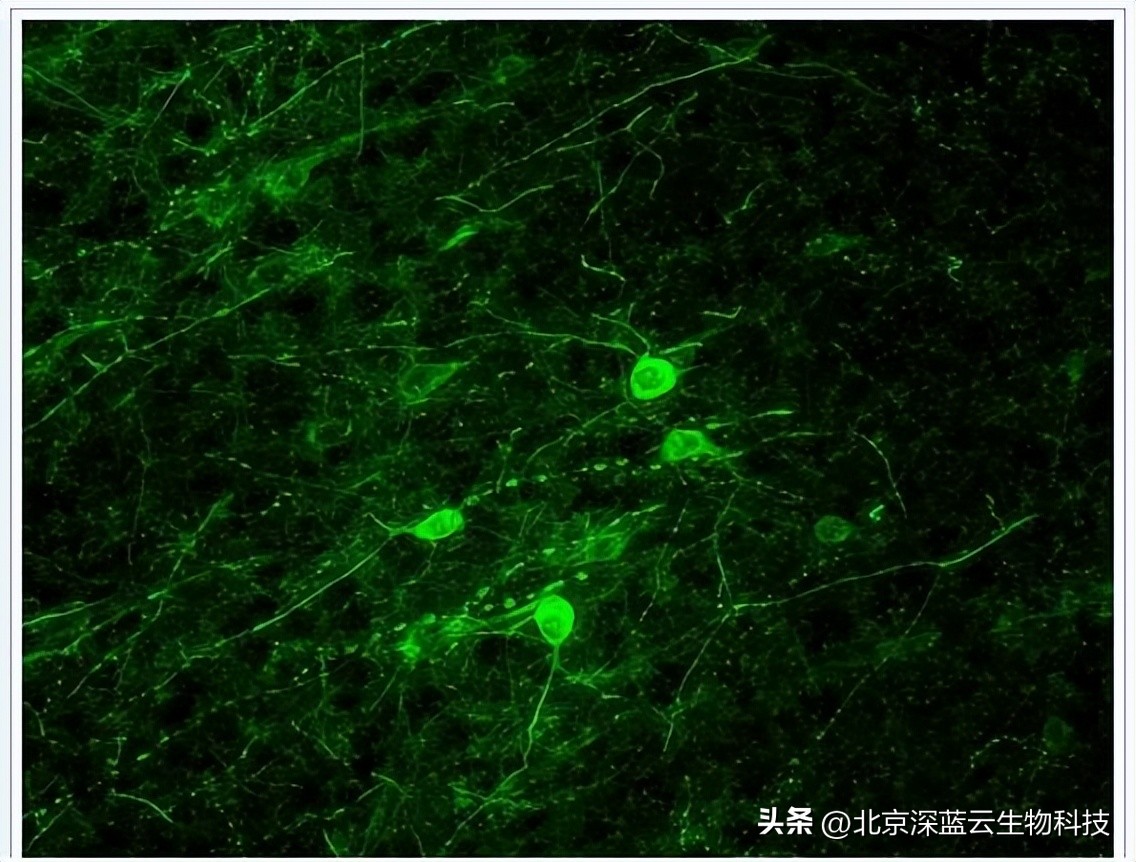 免疫荧光试验和免疫沉淀试验区别,免疫荧光显微技术是什么