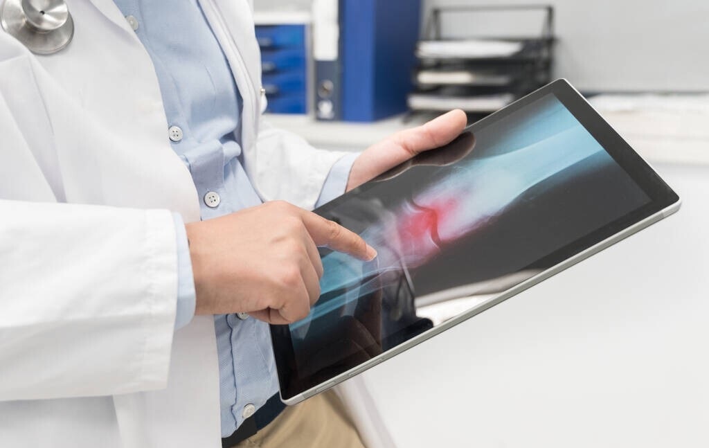 氨糖真的有利于保护膝盖软骨吗,氨糖真的有效吗