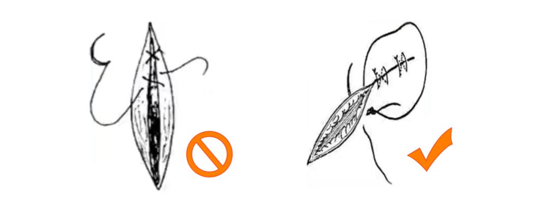 外科各种缝合方法的适用情况,外科操作缝合