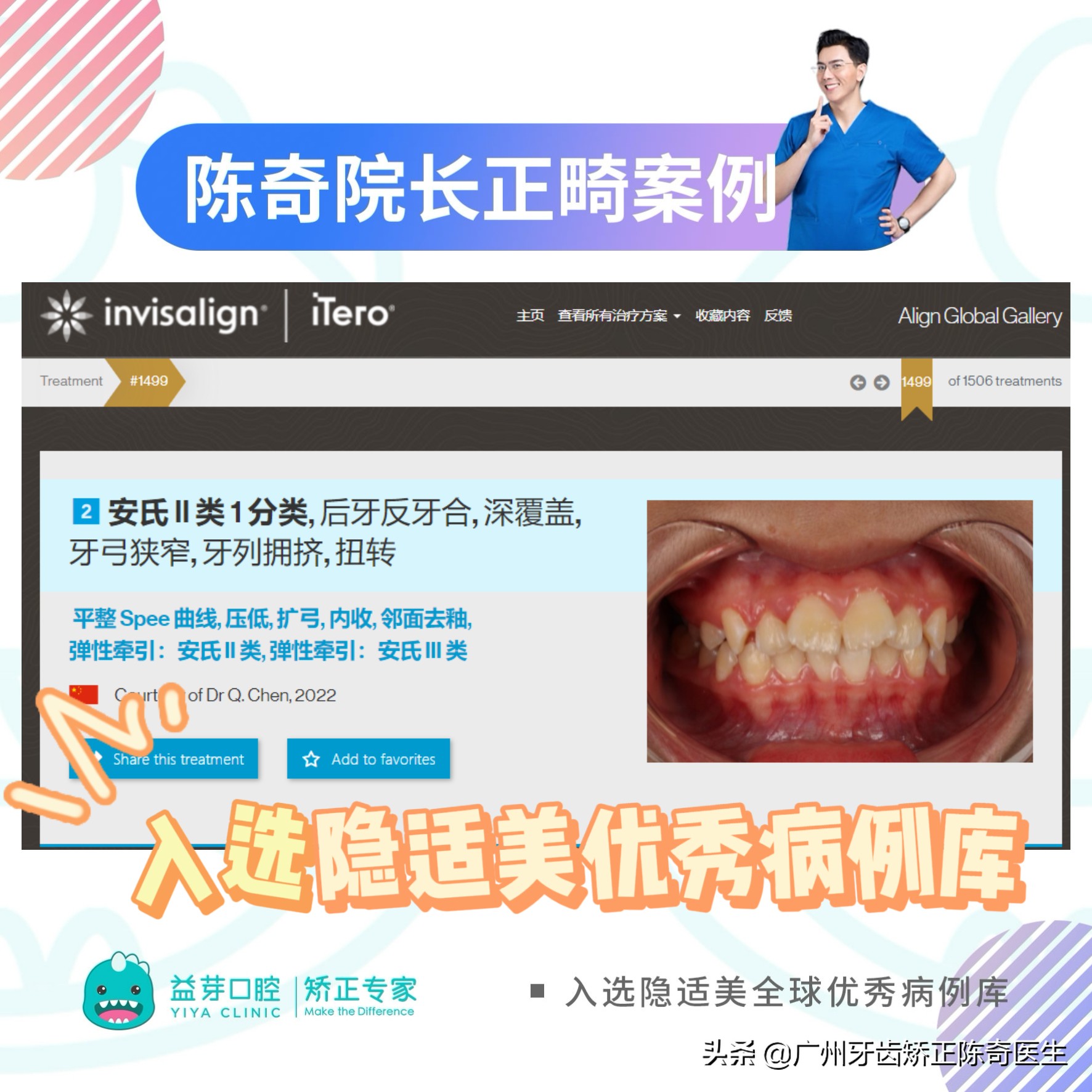 11岁女孩牙齿前突需要扩弓吗,16岁女生上颌骨前突矫正