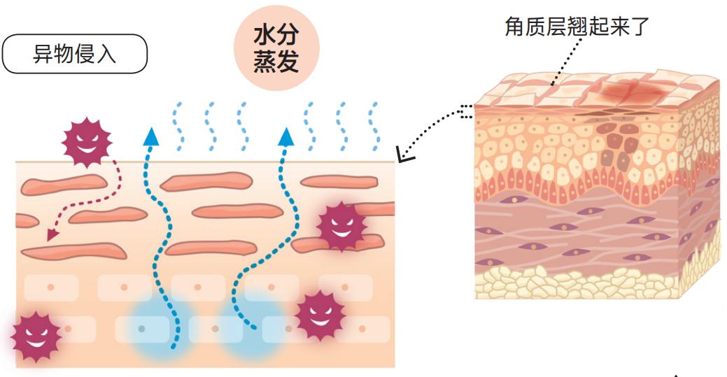 粉尘过敏的最好解决办法是什么,粉尘过敏吃什么药效果最好