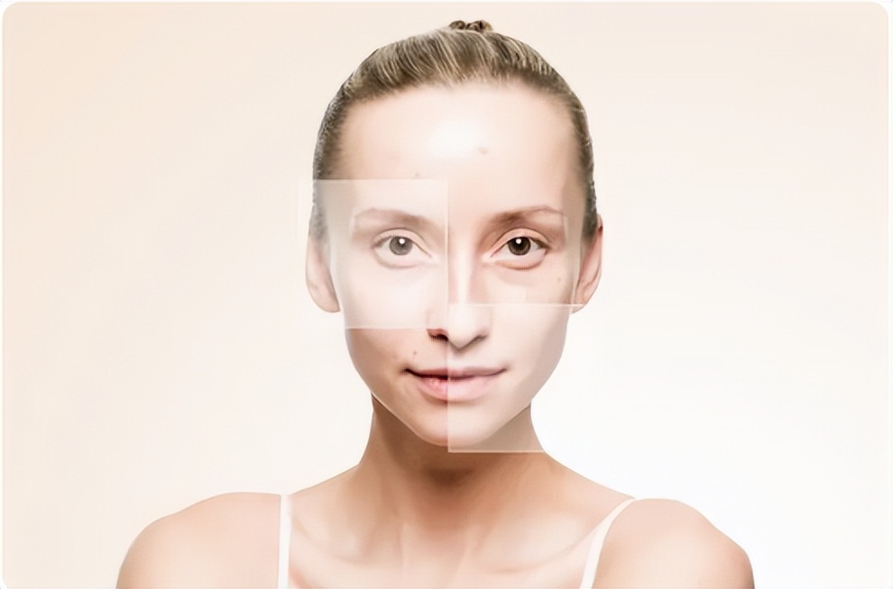 油脂粒粉刺怎么去除,萃雪肤祛痘产品副作用是啥