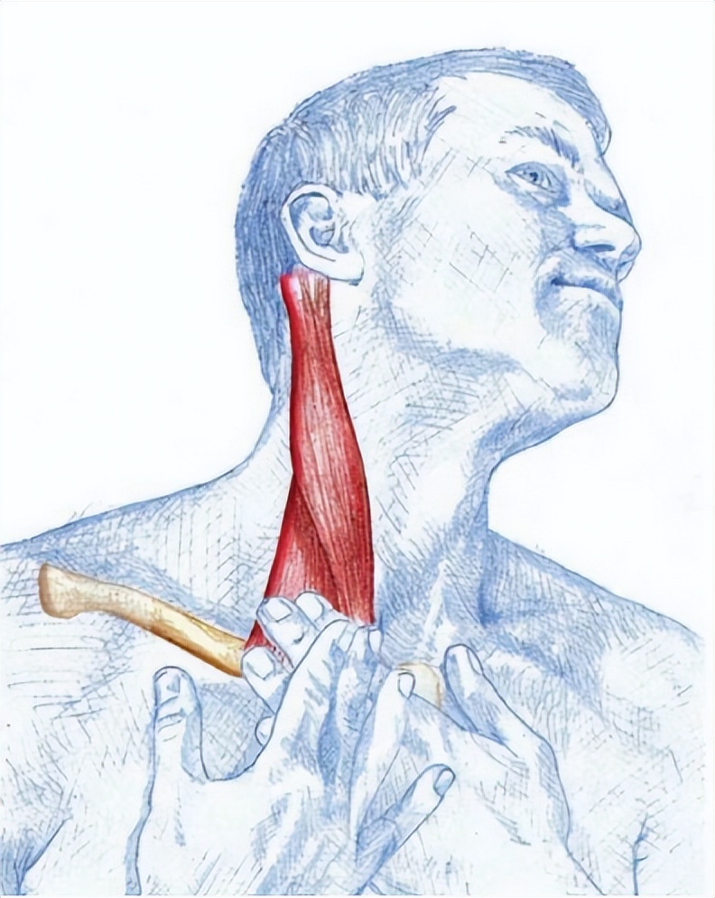颈复康治疗颈源性头痛吗,颈源性头痛整体解决方案