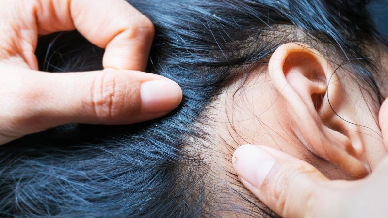 女子腹部痒，医生用镊子夹出16只阴虱！原来阴虱有4个传播途径