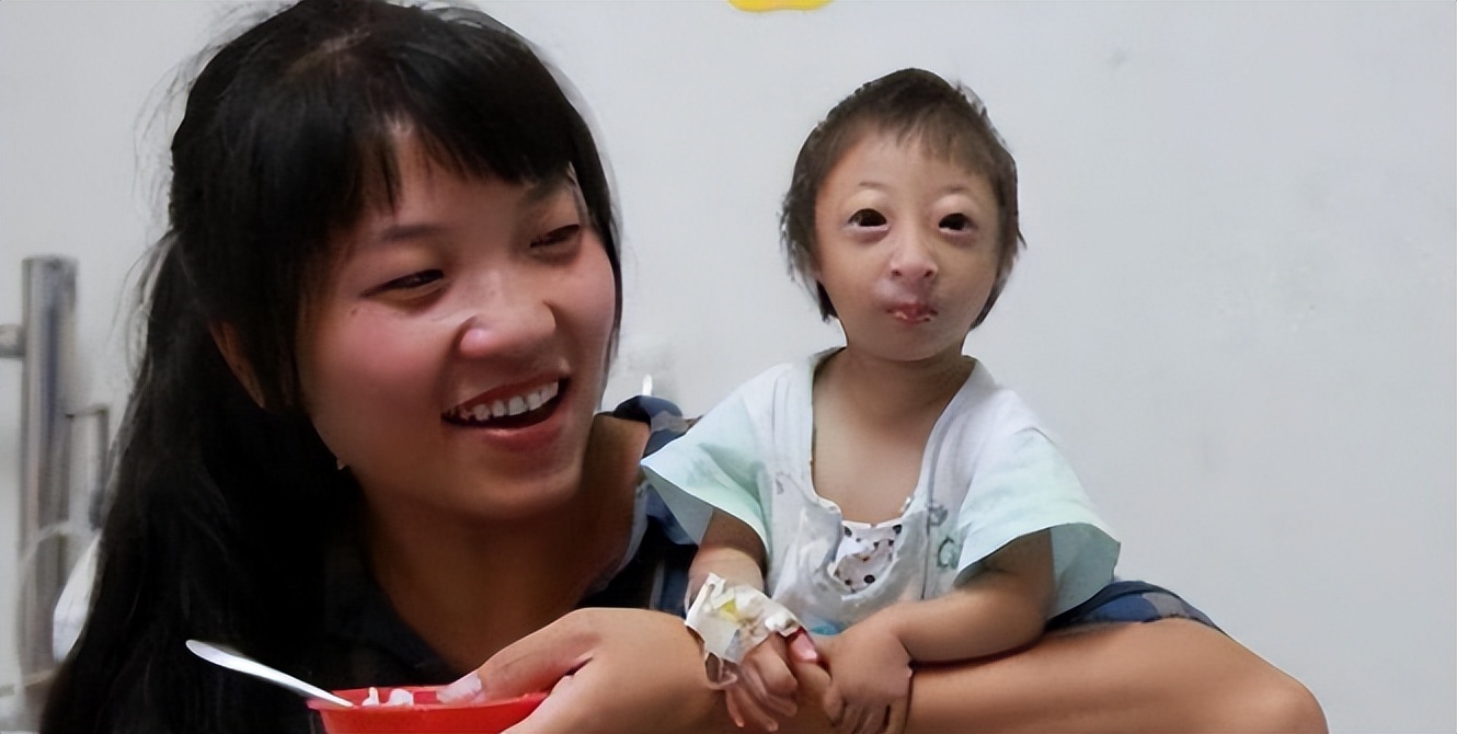 湖南生下小猴子卖给马戏团,湖南一产妇生下“小猴子”