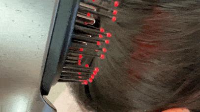 倍轻松scalp3养发梳限定款,倍轻松头皮按摩梳scalp3s