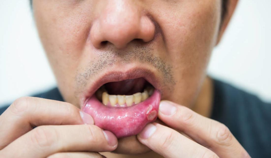 24岁姑娘丧失生育能力,24岁女孩失去了生育