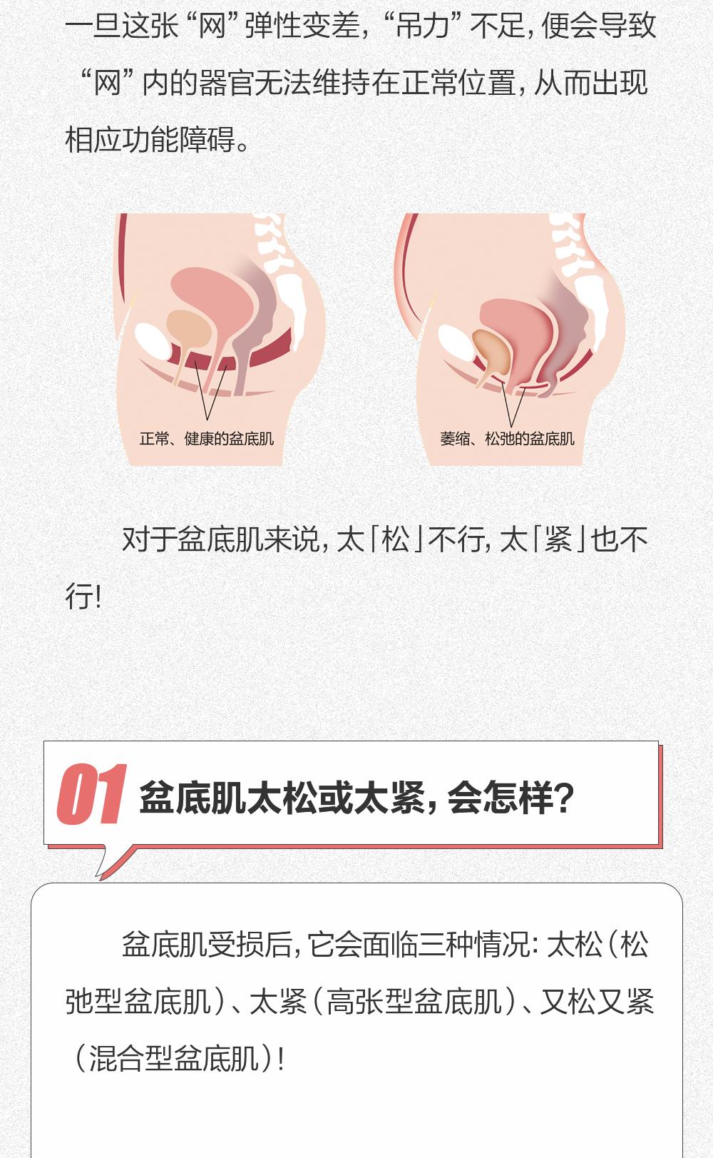 怎么改善盆底肌松,怎么确定盆底肌松弛