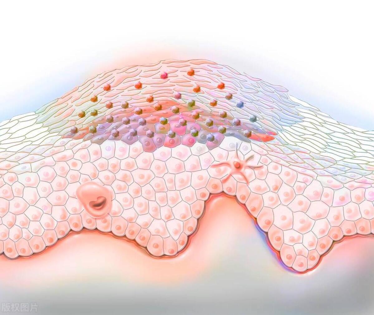 皮肤病反复需要注意哪四点,皮肤病生活常识误区多