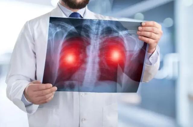 张庆祥医美,张庆祥医生癌症去世