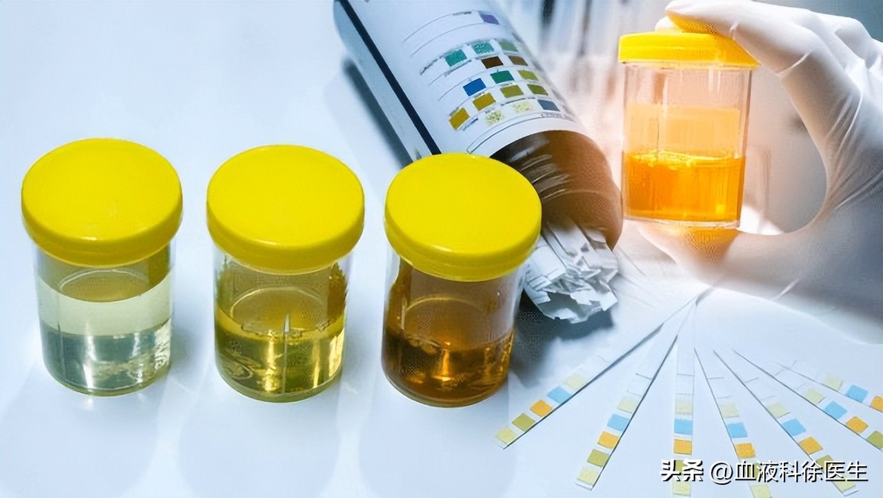 体检出肾结石怎么去医院问诊,体检检查出肾结石怎么处理