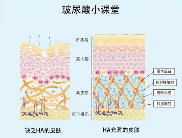 为什么嘴巴的玻尿酸吸收得很快,如何判断是真的玻尿酸
