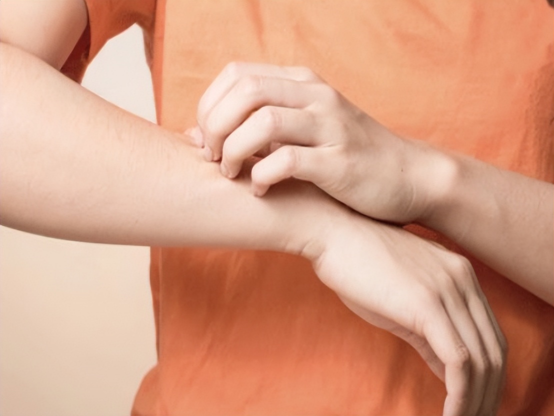 神经性皮炎喝过中药后为啥更痒,手越抓越痒是皮炎还是真菌感染