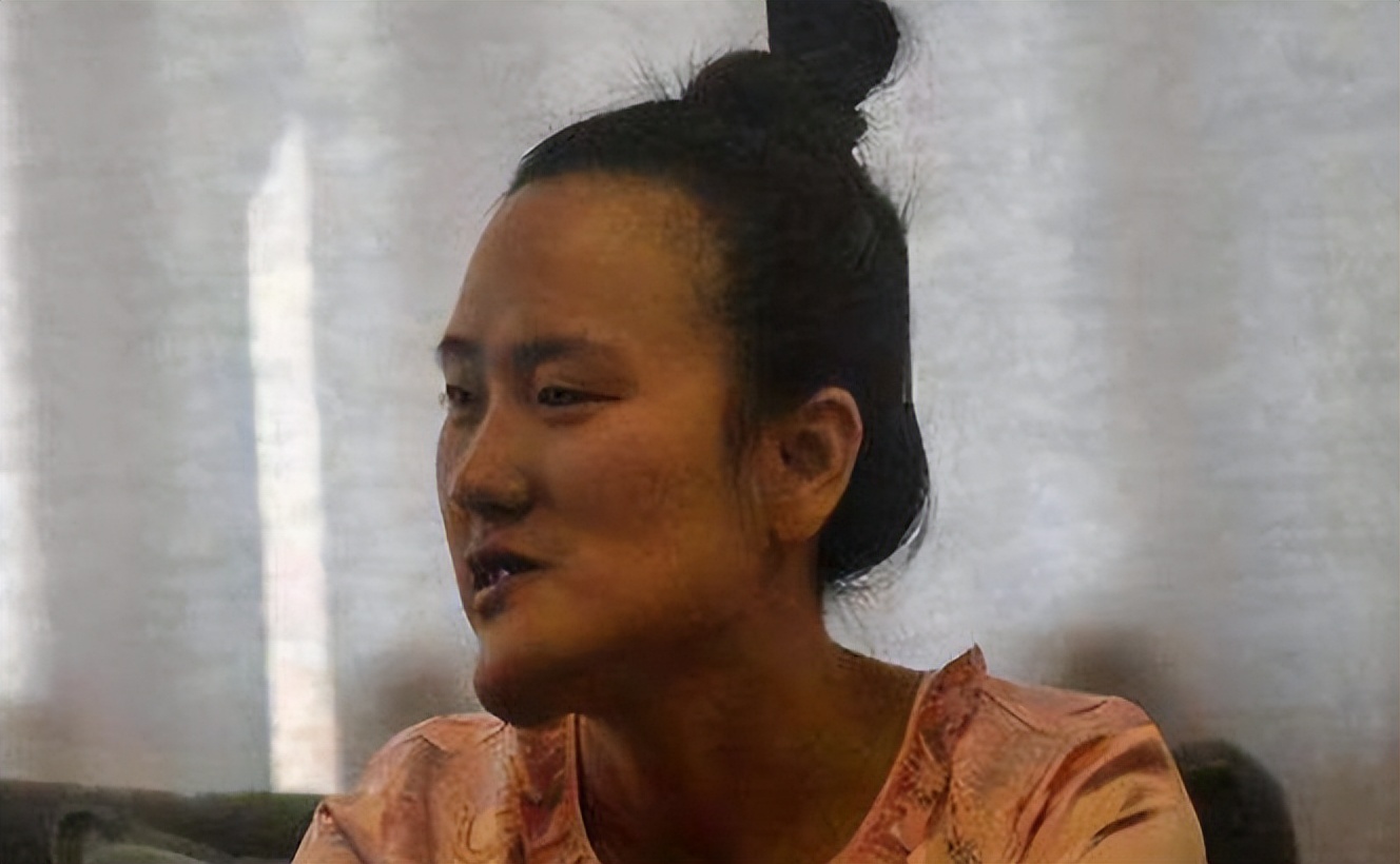 辽宁歪脸女孩，家境贫寒父母双亡，整容变美后拒百万薪只为当老师