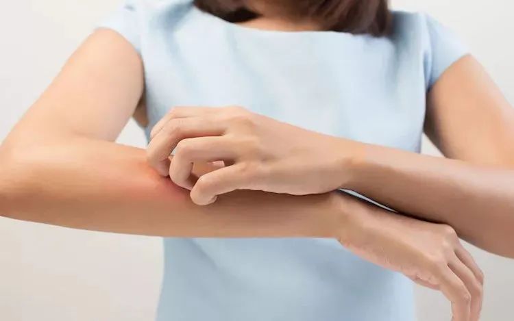 皮肤好痒啊,皮肤痒越挠越痒买什么药