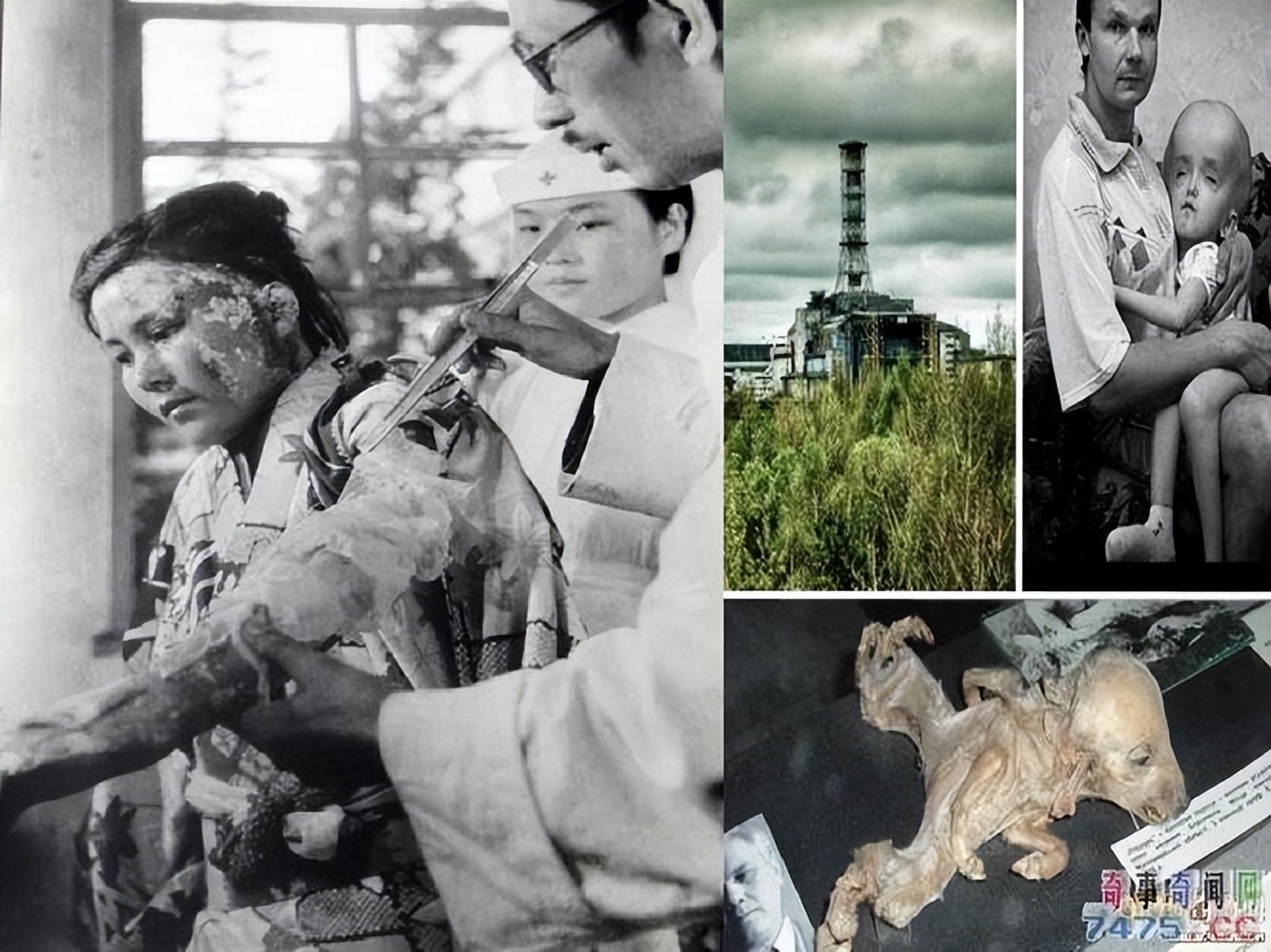 核辐射是一种放射性衰变过程，那么它对人体究竟有多大的危害？