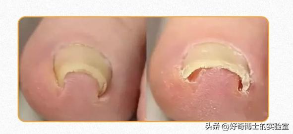 哪些鞋子穿着不会伤脚,穿什么类型的鞋子不伤脚