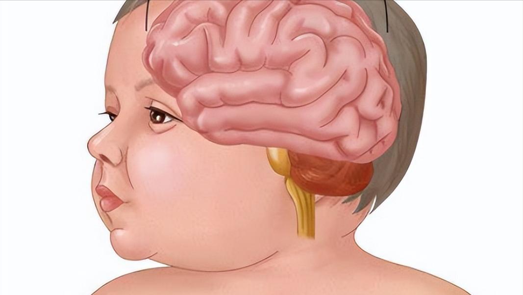 5岁语言发育迟缓终于开口说话了,多大孩子不会说话算是语言迟缓