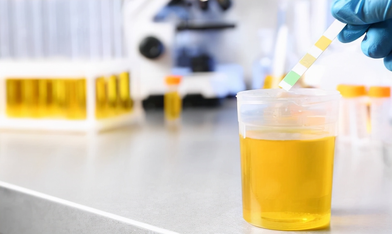 尿蛋白高是什么原因造成的肾病,糖尿病肾病如何降低尿蛋白的水平