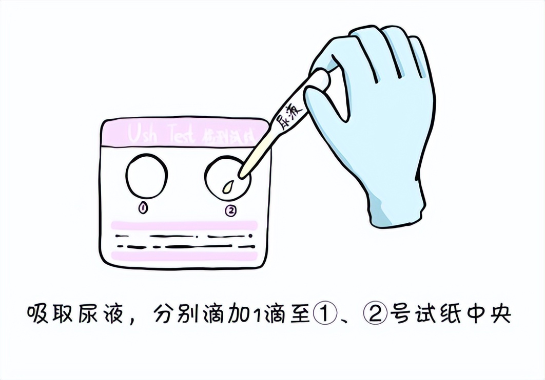 查出宫颈上皮瘤样病变怎么办？别慌，它不等于宫颈癌！