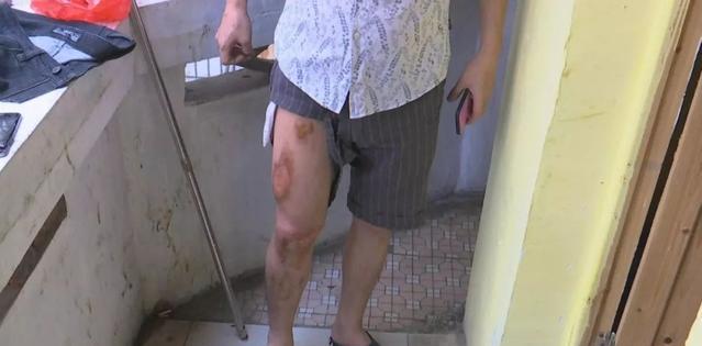 用了4年的“苹果6”爆炸了！不用充电，放进口袋里就行了……