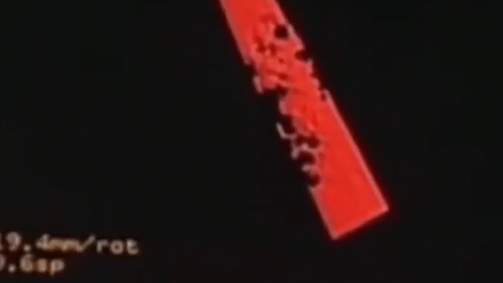 云南男子口臭手术后现在怎么样了,云南男子口臭查出了大毛病