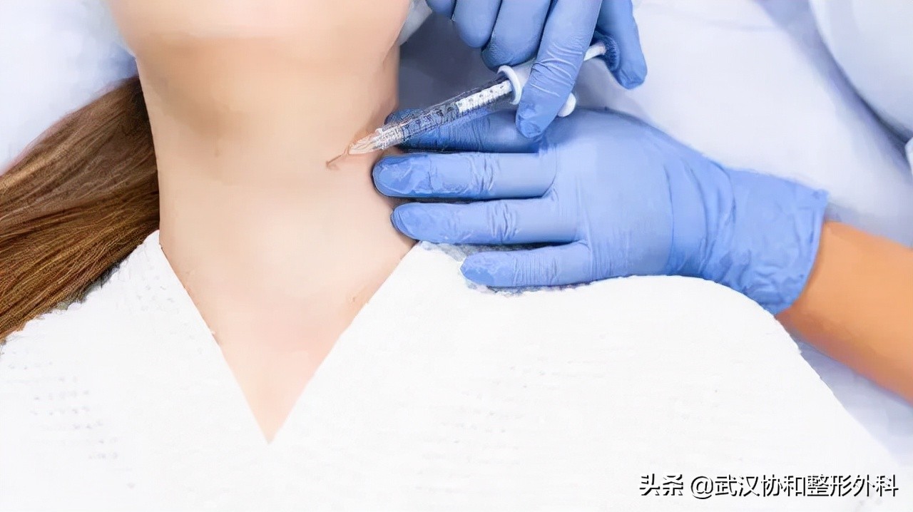 出现颈纹有没有什么好办法去,刮颈部能去除颈纹吗