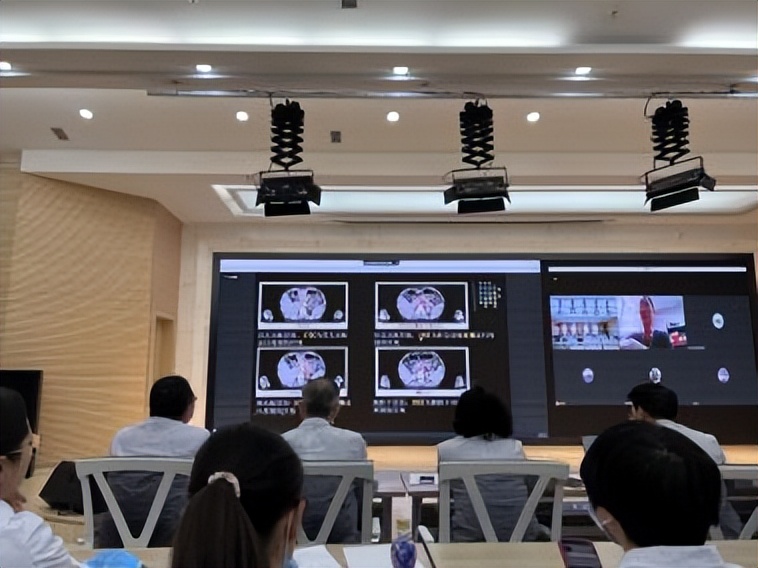 因为有你“胰”生平安——重（碳）离子治疗胰腺癌五问