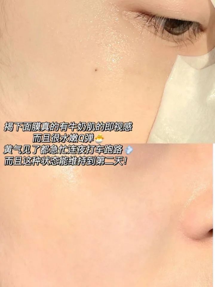 2021美白淡斑面膜十大排行榜口碑,美白祛斑补水保湿面膜测评