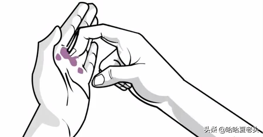 如何洗掉皮肤上染发剂,如何洗掉皮肤上的沥青