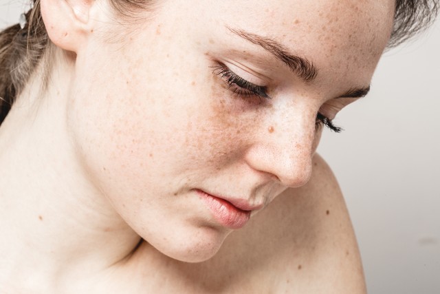 买祛斑霜还有专家指导你用的吗,之前买过祛斑霜