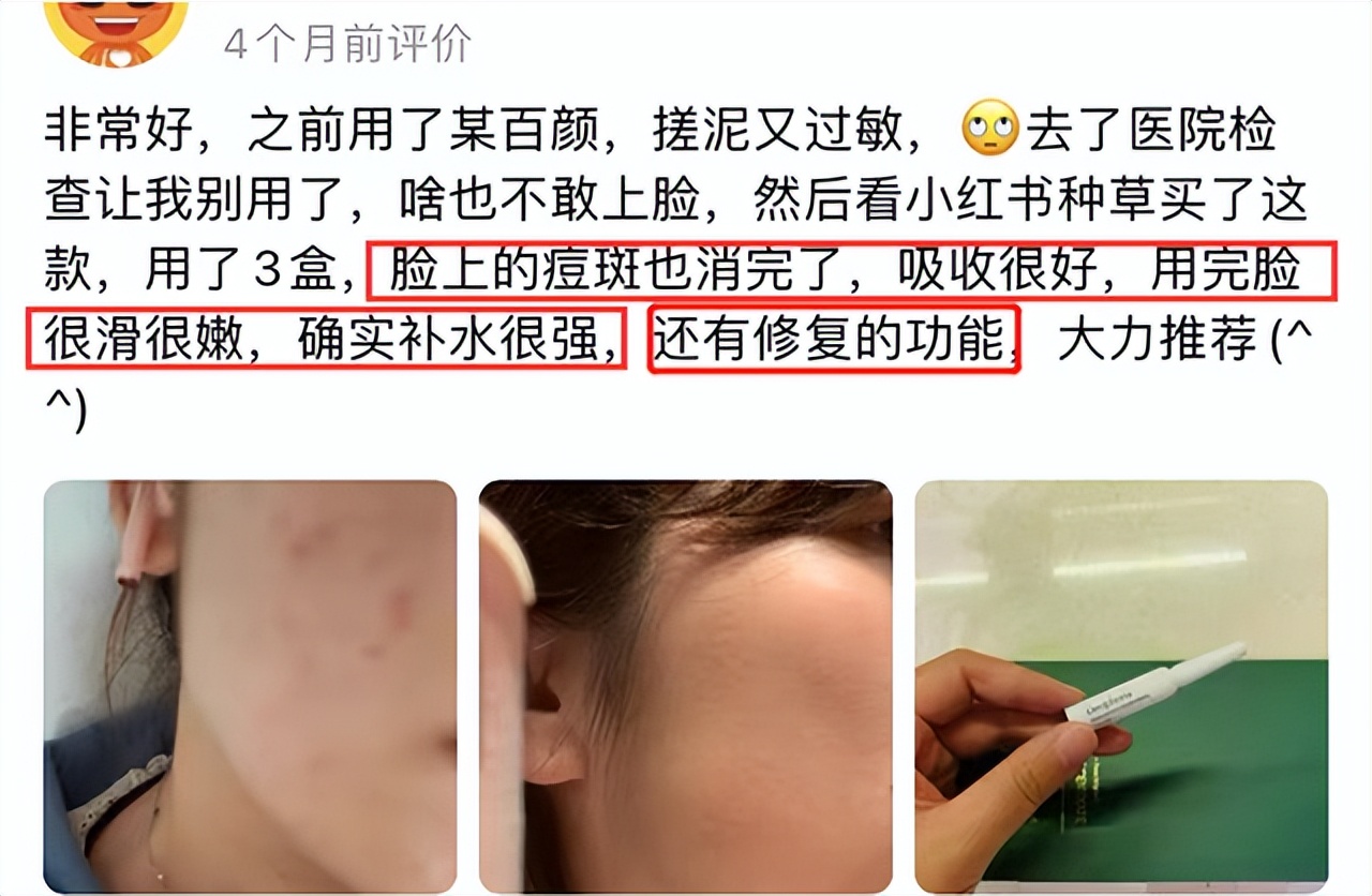 德梵妮Deuphoria，孕妇也能用的玻尿酸