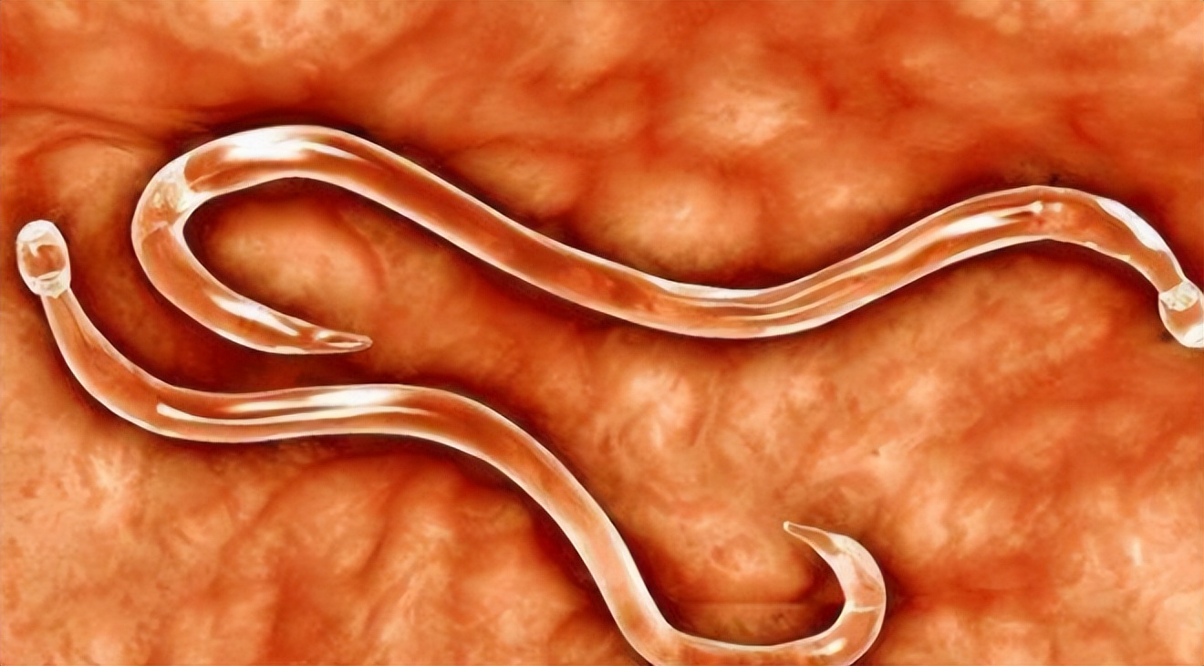 肛门反复潮湿发痒是什么原因,肛门潮湿发痒是什么原因如何治疗