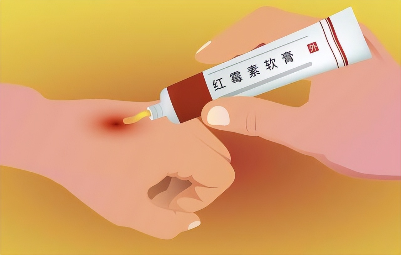 老年斑破损用红霉素软膏有效吗,红霉素软膏和开塞露能祛老年斑吗