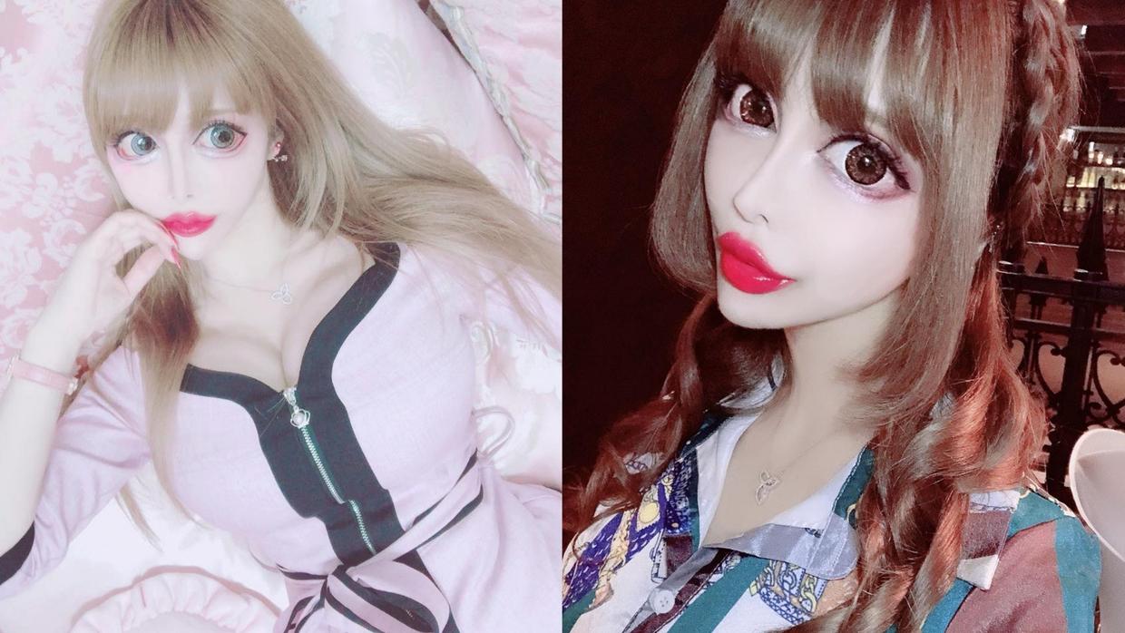 日本1米5小哥砸1600万疯狂整容增高！断骨惨烈过程吓傻网友