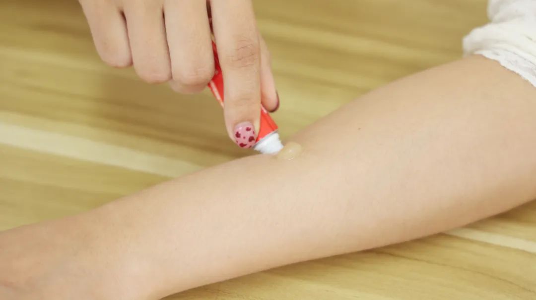 湿疹水泡很痒是怎么回事,皮肤瘙痒湿疹怎么快速治疗