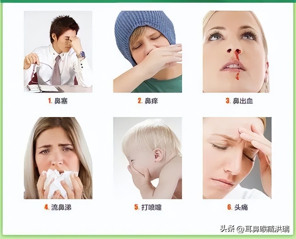 薄荷滴鼻液能治疗鼻炎吗,薄荷油滴鼻液能治疗过敏性鼻炎吗