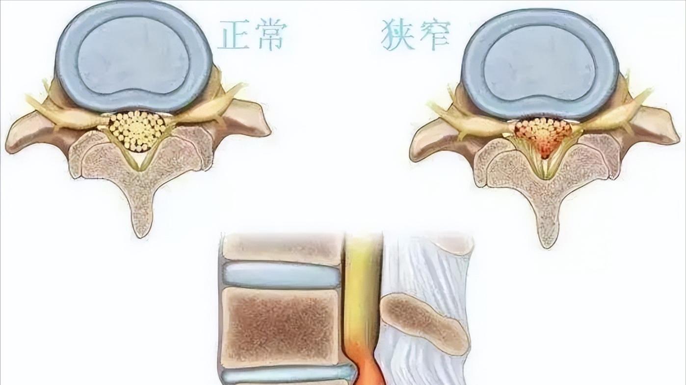 骨科医生忠告视频,骨科医师对人体的忠告