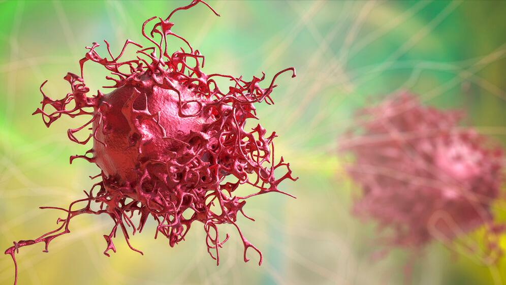 身体出现5种暗示癌症找上门,身体出现什么信号说明体内有癌