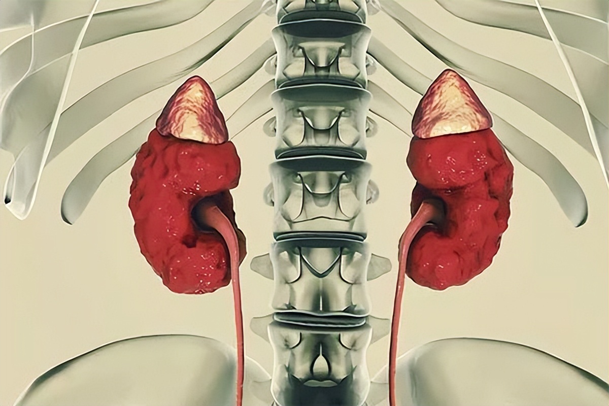 中医治疗多囊肾最新治疗方法,男性多囊肾有什么症状