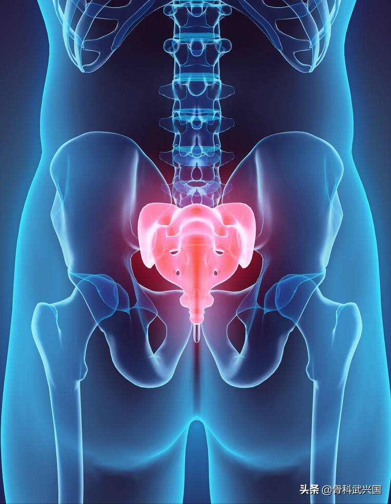 女性尾骨痛是什么妇科病,女性尾骨痛是盆腔有关吗